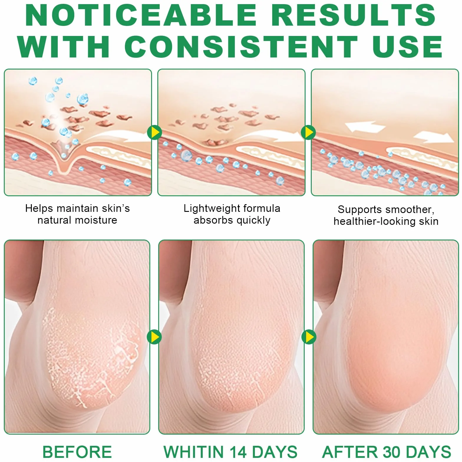 Aloe krem do pielęgnacji stóp
