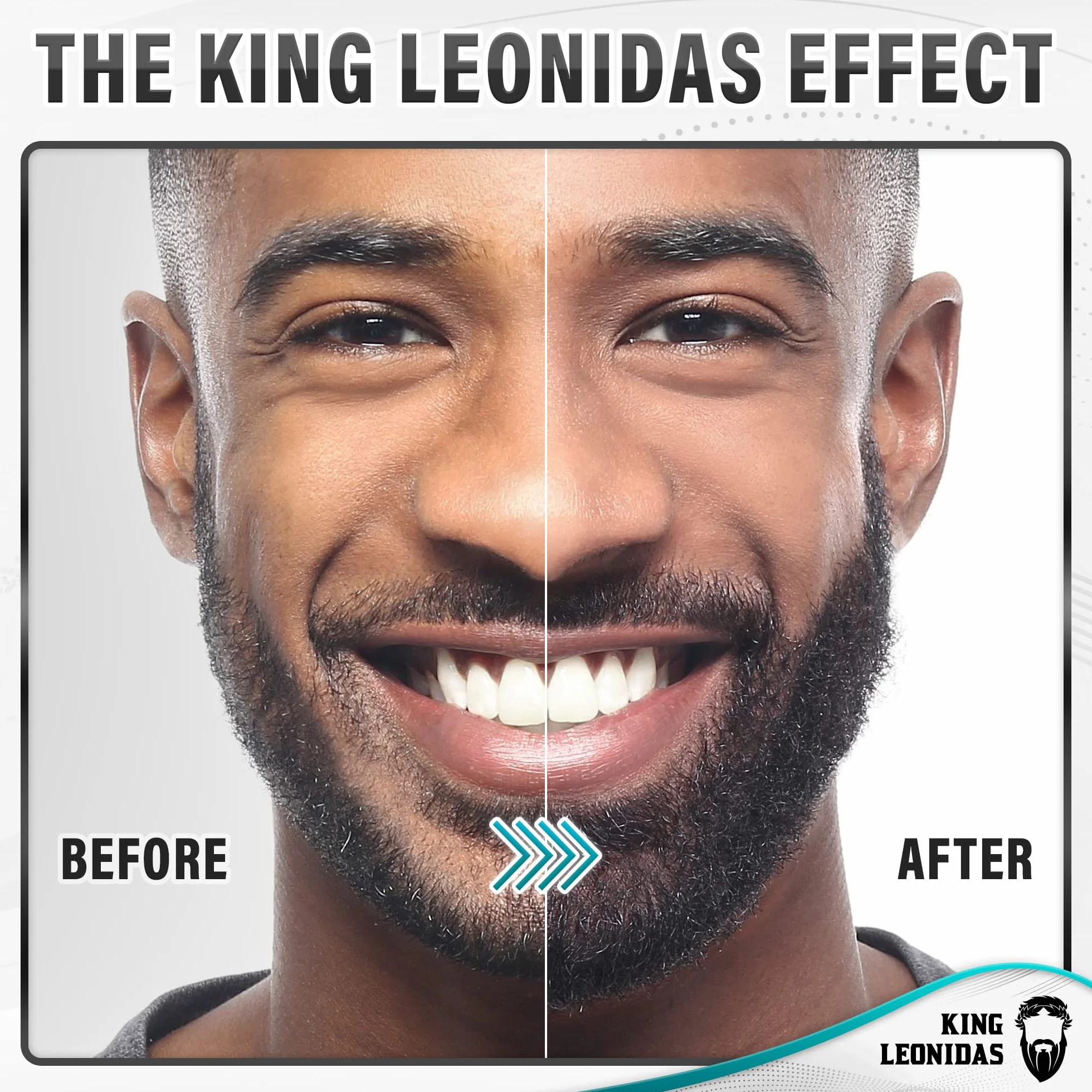 King Leonidas Beard Derma Roller dla mężczyzn, 0,30 mm Titanium Micro-Needling Derma Roller do zarostu i wzrostu brody
