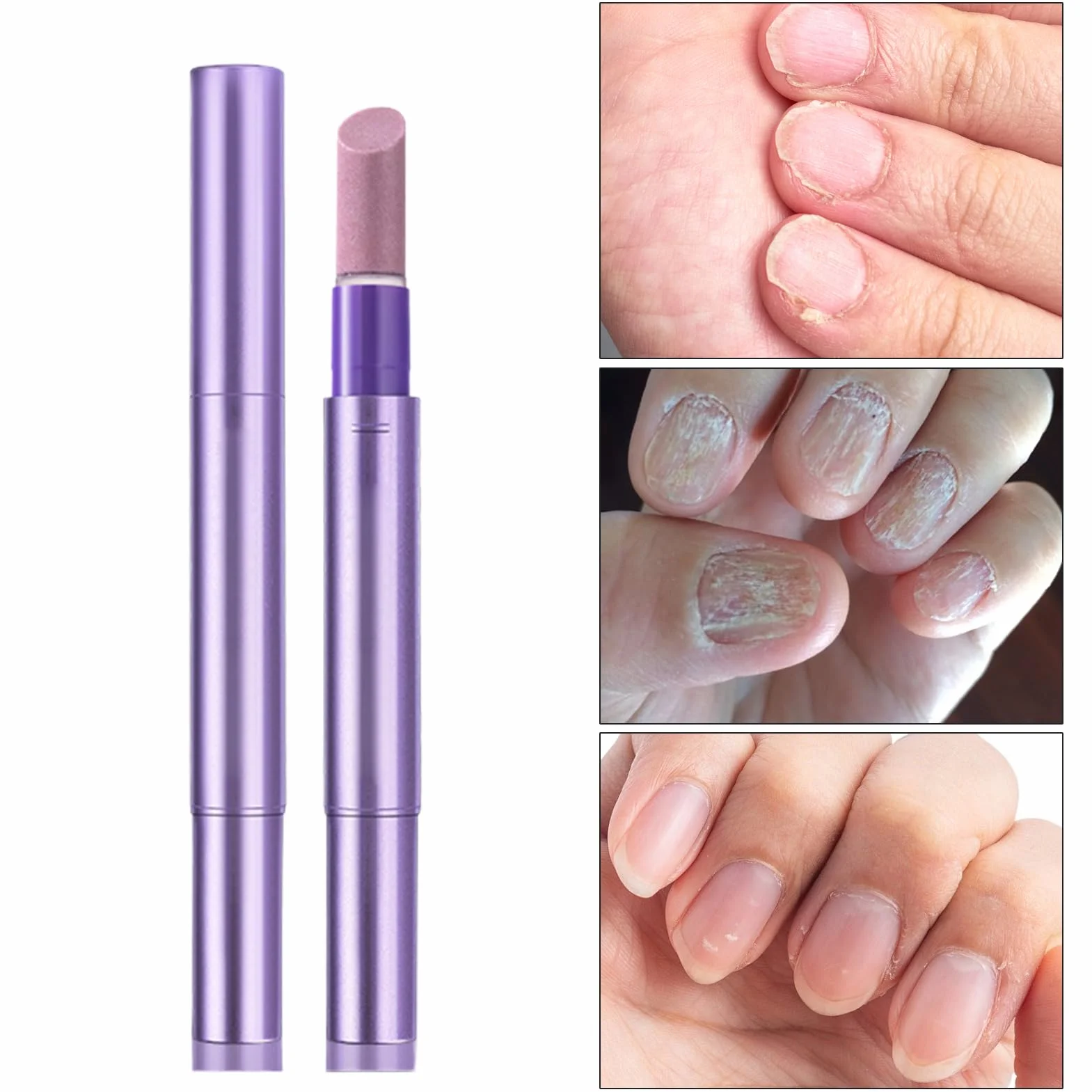 Ceramiczny długopis do skórek z pielęgnacją i nawilżaniem paznokci 2,5 ml