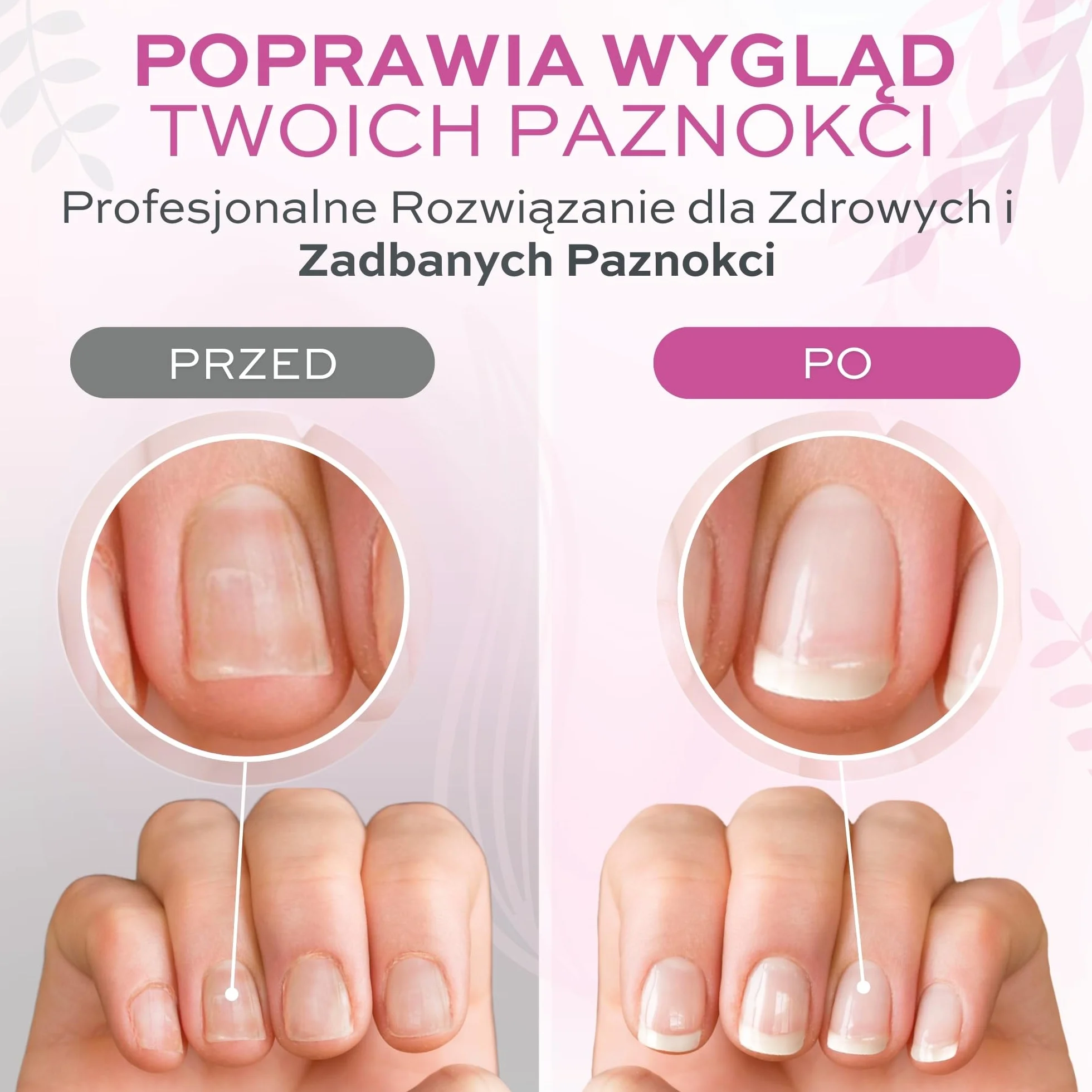 Lakier Przeciw Gryzieniu Paznokci 12 ml - Lakier przeciw gryzieniu paznokci dla dorosłych i dzieci.