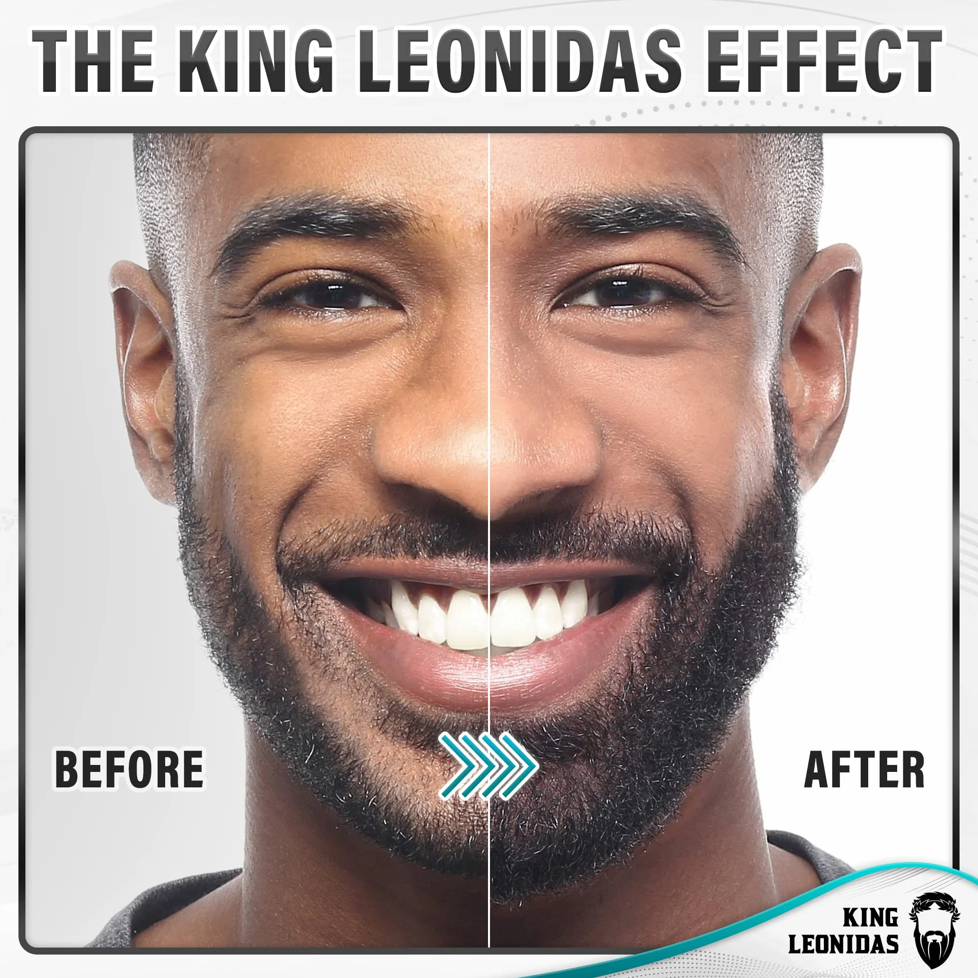 Zestaw do wzrostu brody King Leonidas z rolką Derma Roller 0,25 mm Microneedling Tool dla mężczyzn, profesjonalna pielęgnacja włosów na twarzy Pielęgnacja z balsamem do brody i olejkiem do brody