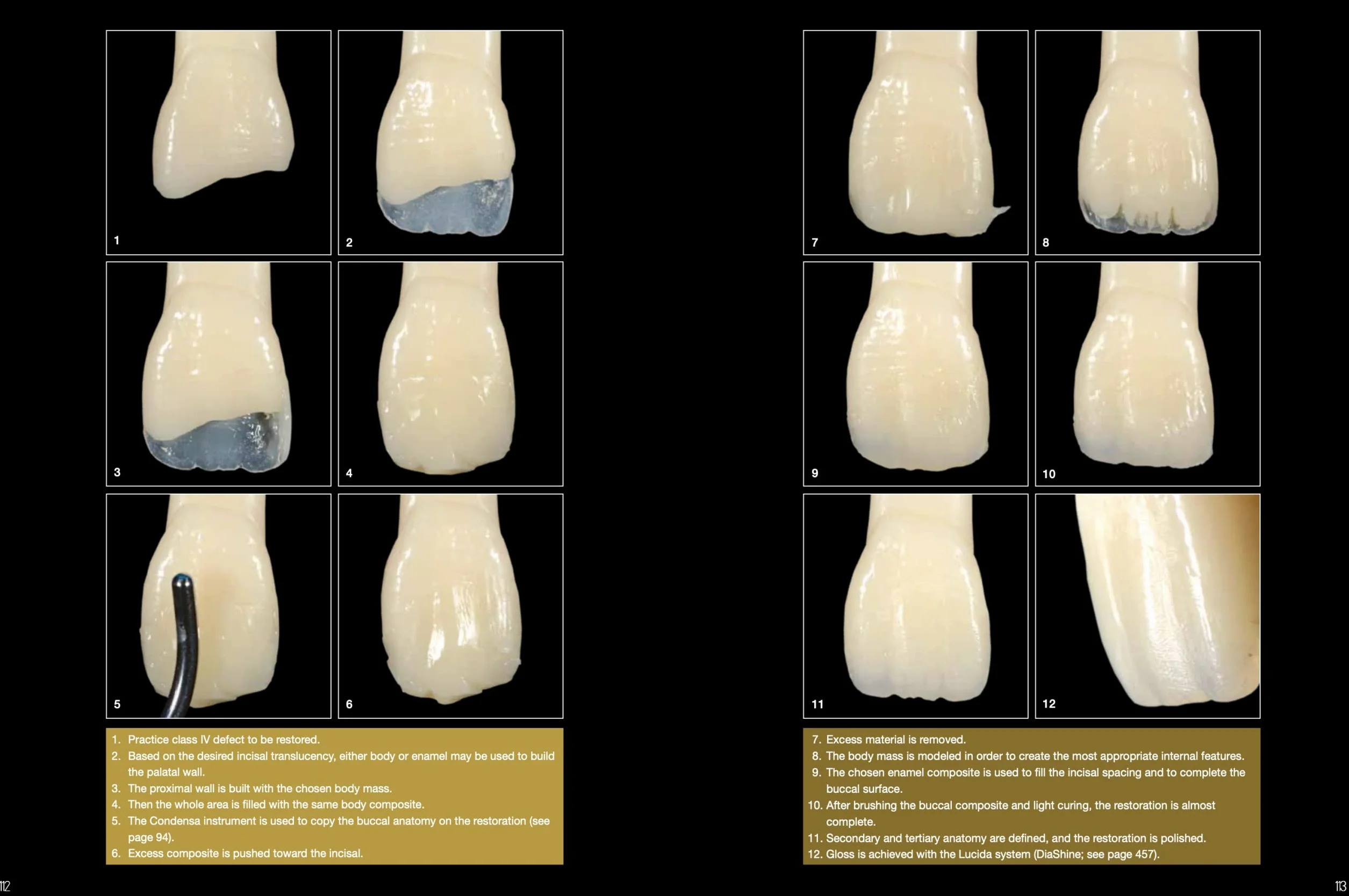 Layers 2. Direct composites: the Styleitaliano clinical secrets. Nuova ediz.