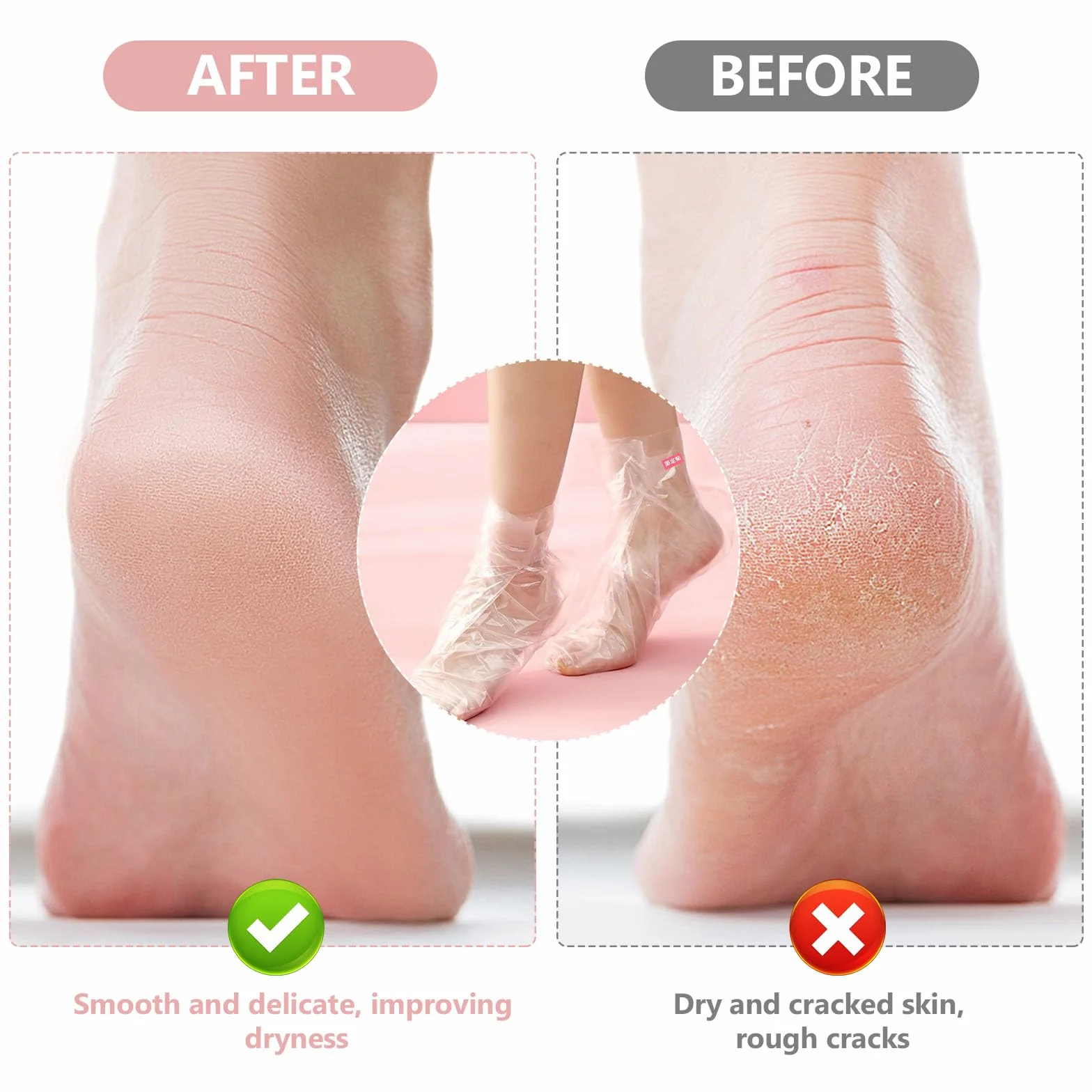 Parafinowe maseczki do stóp, skarpety i rękawiczki, ochraniacze, wkładki, maska do pedicure Hot Spa 200 sztuk