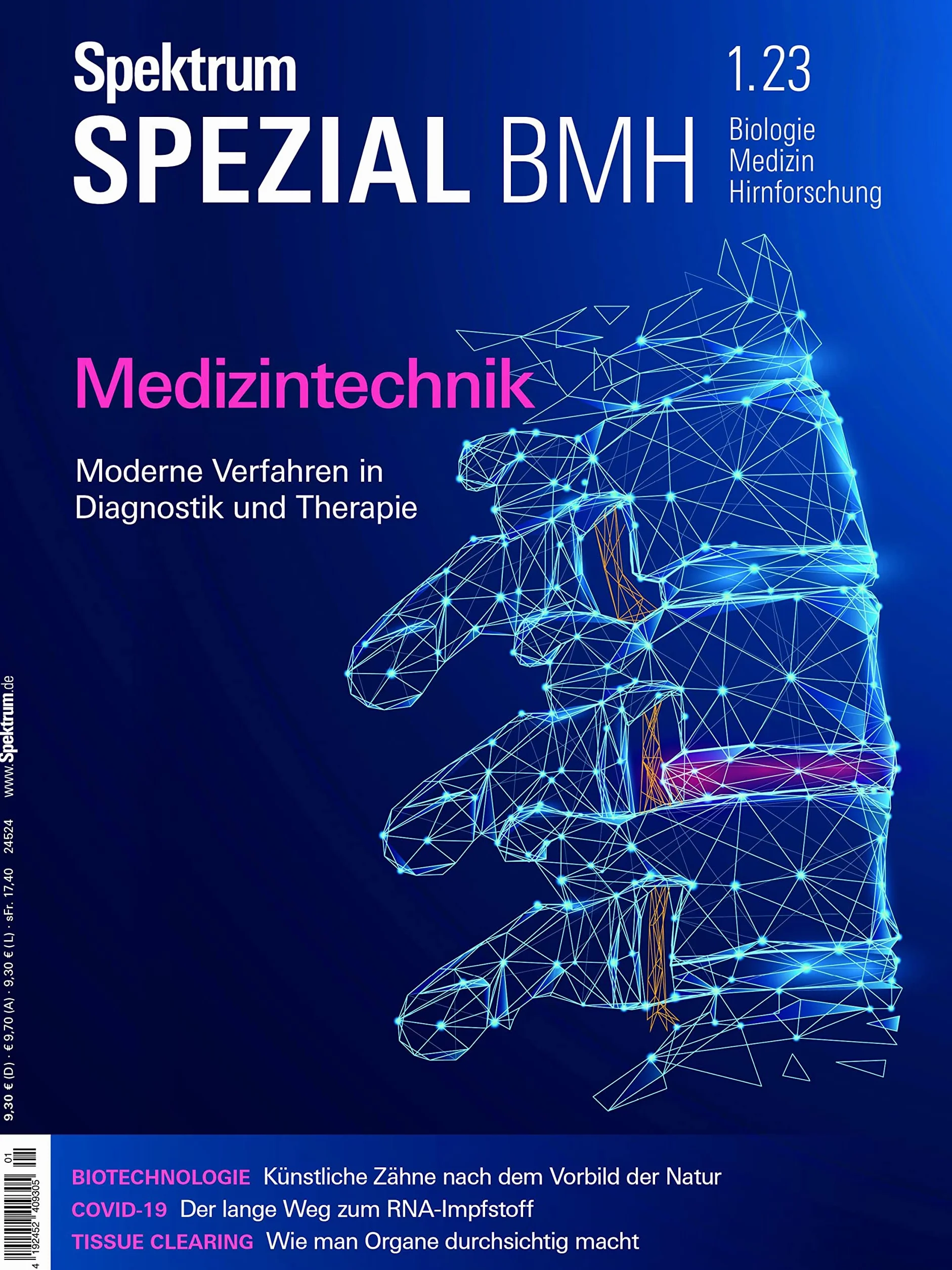 Spektrum Spezial - Medizintechnik: Moderne Verfahren in Diagnostik und Therapie: 1/2023