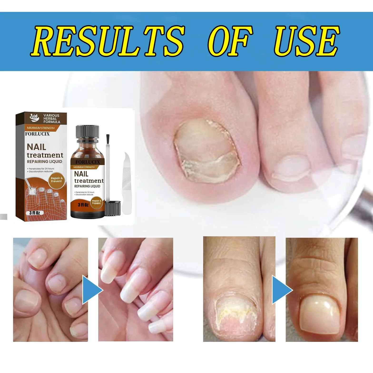 Extra Strength 3 Fl Oz Brown