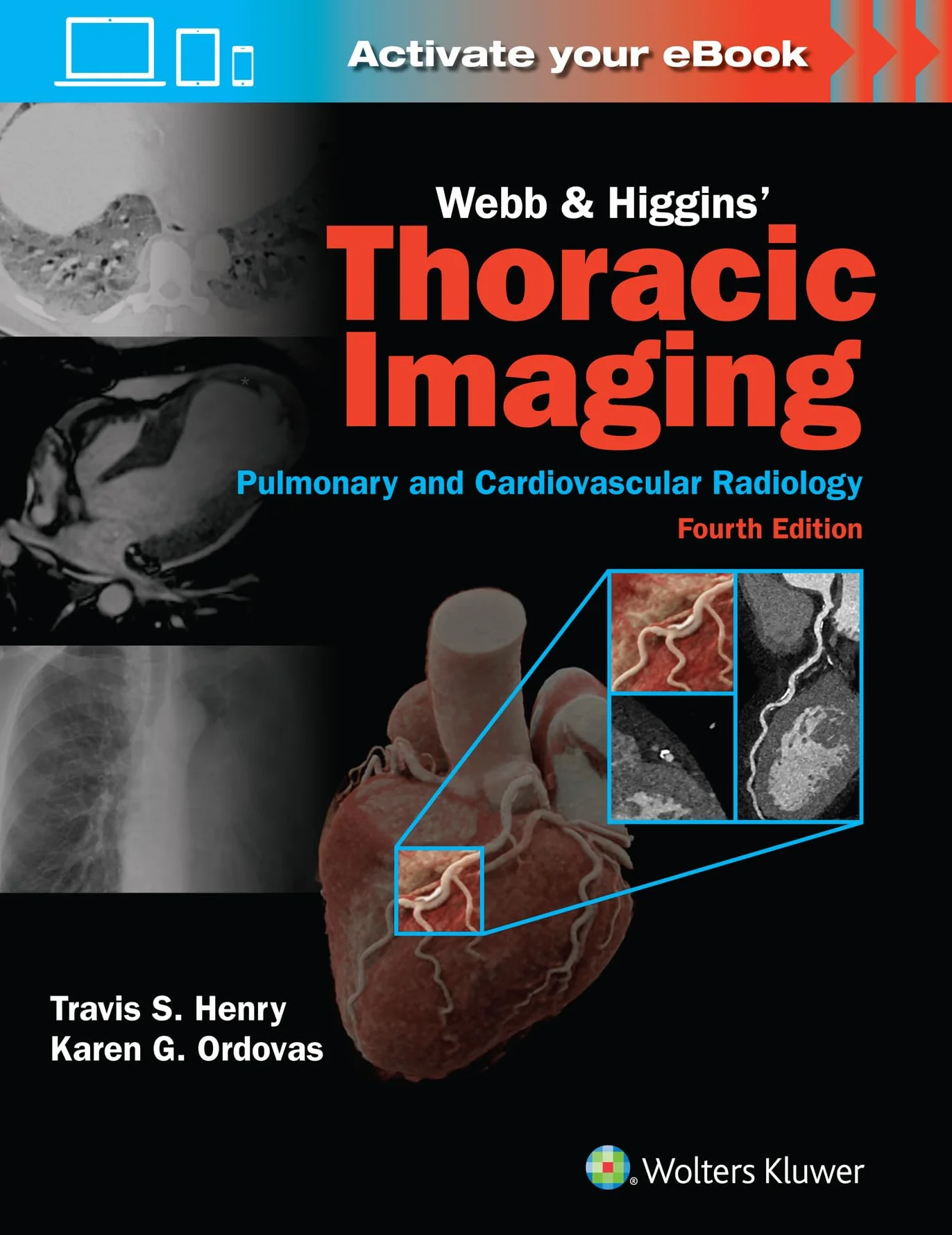 Webb & Higgins Thoracic Imaging: Print + eBook with Multimedia