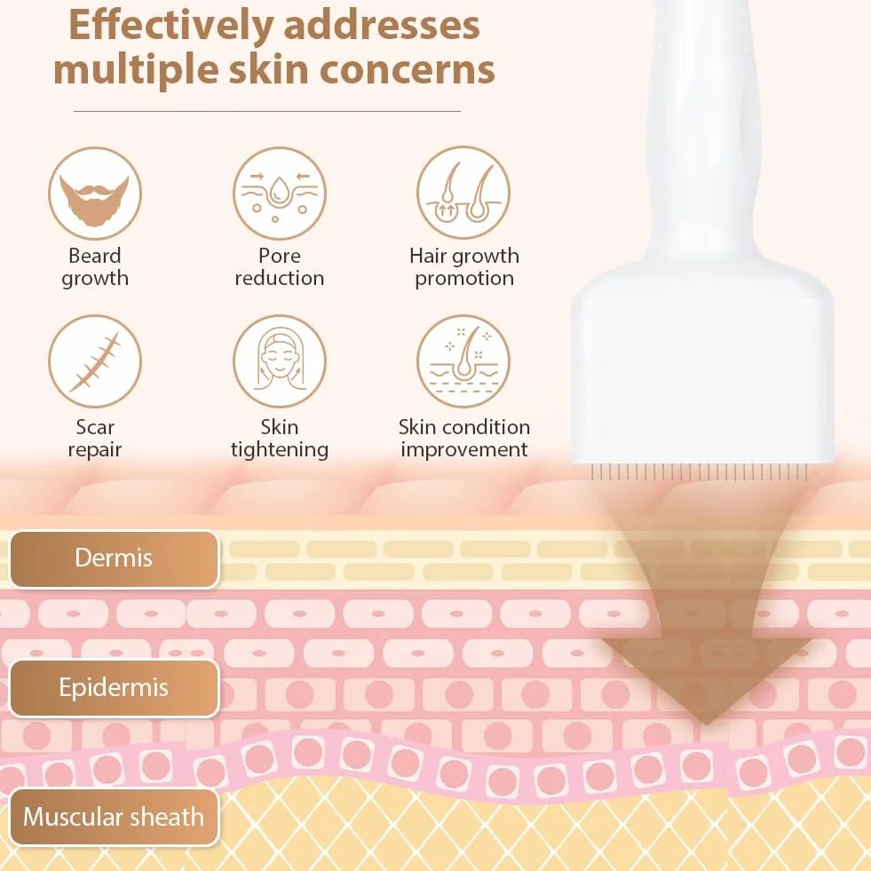 Flintronic Microneedling twarzy, 0-3 mm Derma Roller, regulowany Dermastamp, z 140 tytanowymi igłami, gładka pielęgnacja skóry w domu, do skóry, włosów, zmarszczek, rozstępów (biały)
