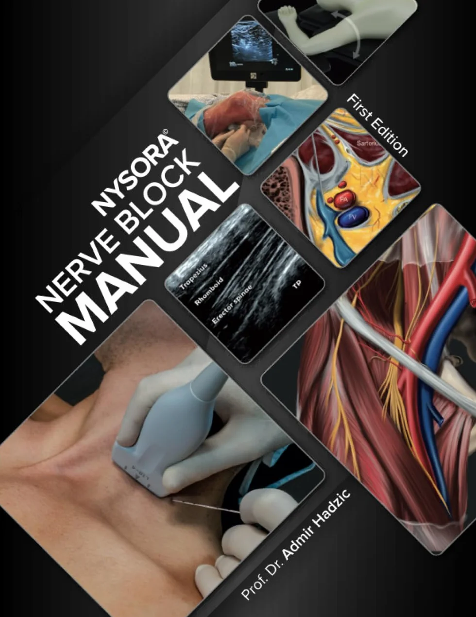 NYSORA Nerve Block Manual: First Edition