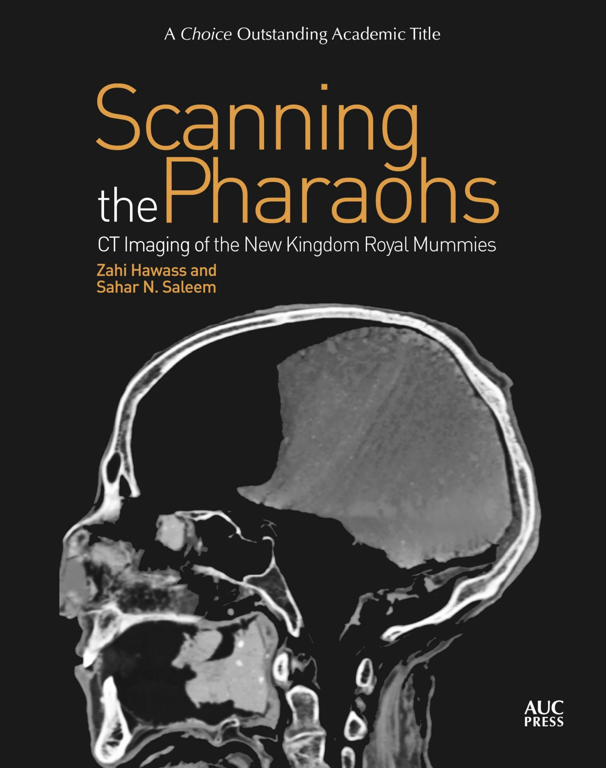 Scanning the Pharaohs: CT Imaging of the New Kingdom Royal Mummies