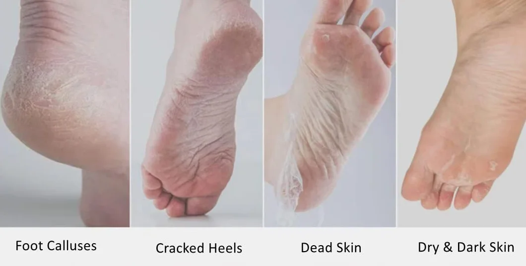 Maseczka peelingująca do stóp lawendowa sucha obumarła skóra naprawa kalusa szorstkie pięty naturalny peeling