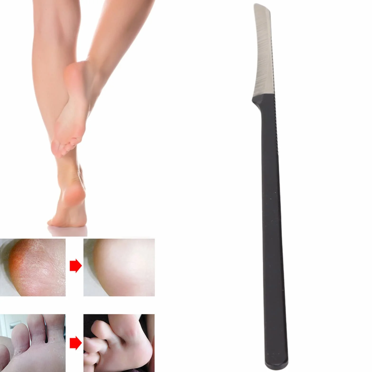 Nóż do pedicure skrobanie nóż salon ze stali nierdzewnej martwy naskórek skrobak do pedicurzysty nóż do pedicure nóż ze stali nierdzewnej skrobanie noża, nóż do pedicure