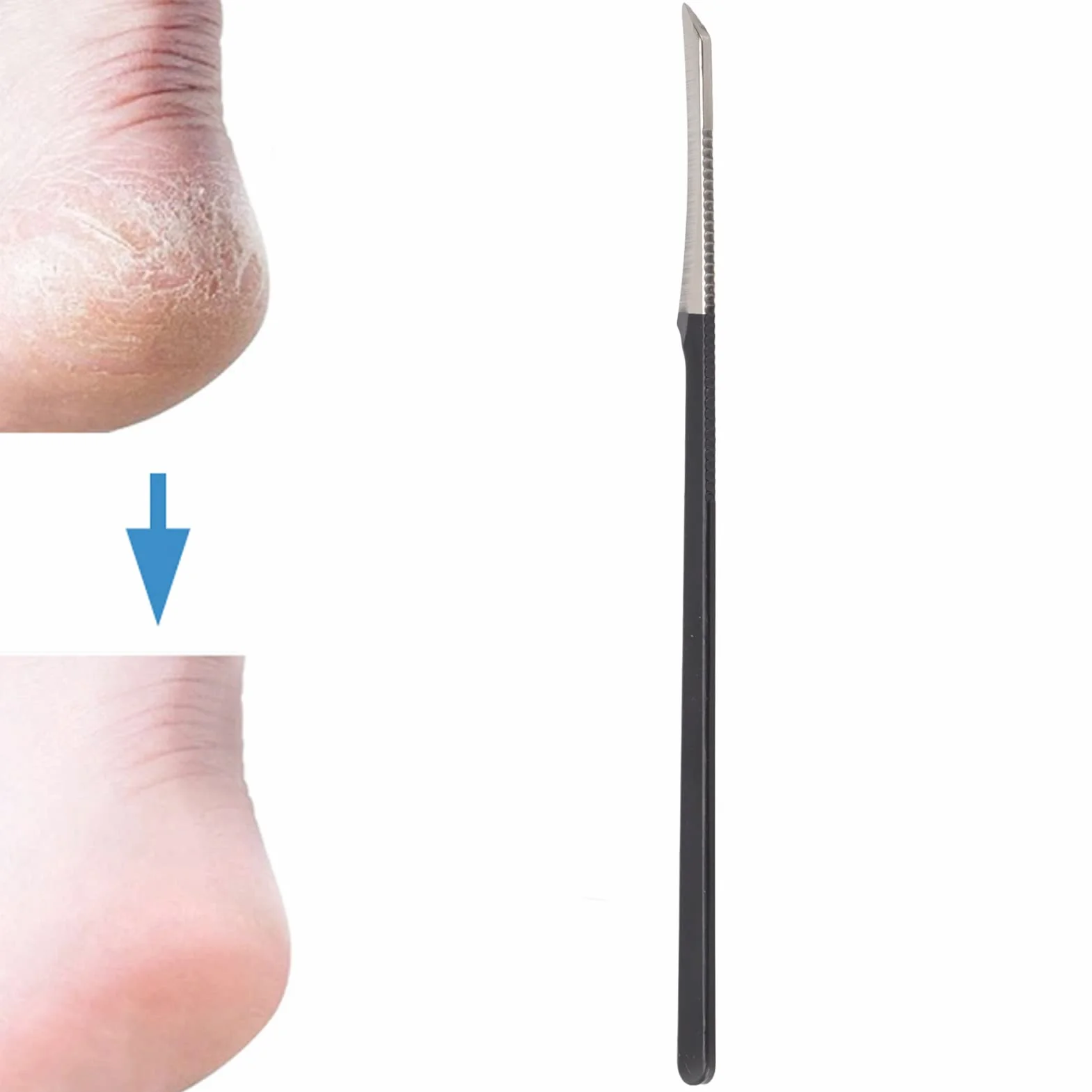Nóż do pedicure skrobanie nóż salon ze stali nierdzewnej martwy naskórek skrobak do pedicurzysty nóż do pedicure nóż ze stali nierdzewnej skrobanie noża, nóż do pedicure