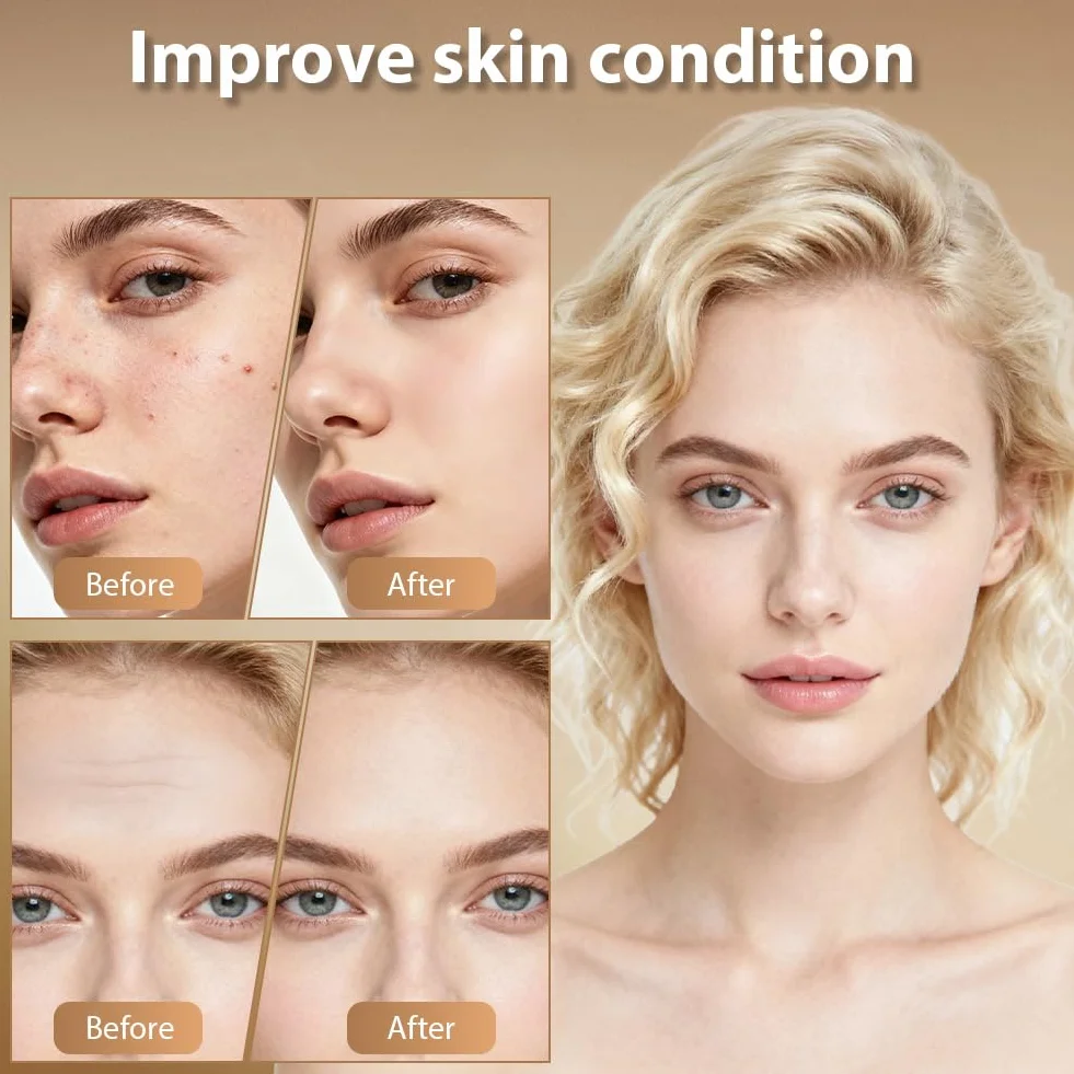 Flintronic Microneedling twarzy, 0-3 mm Derma Roller, regulowany Dermastamp, z 140 tytanowymi igłami, gładka pielęgnacja skóry w domu, do skóry, włosów, zmarszczek, rozstępów (biały)