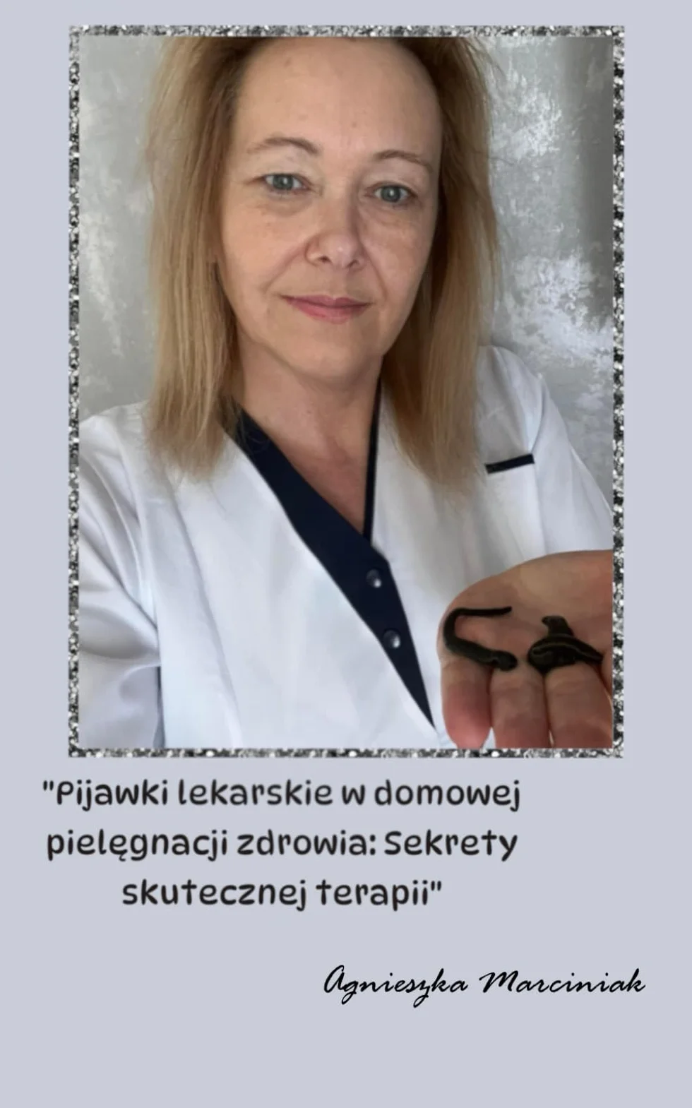Pijawki lekarskie w domowej pielęgnacji zdrowia: Sekrety skutecznej terapii