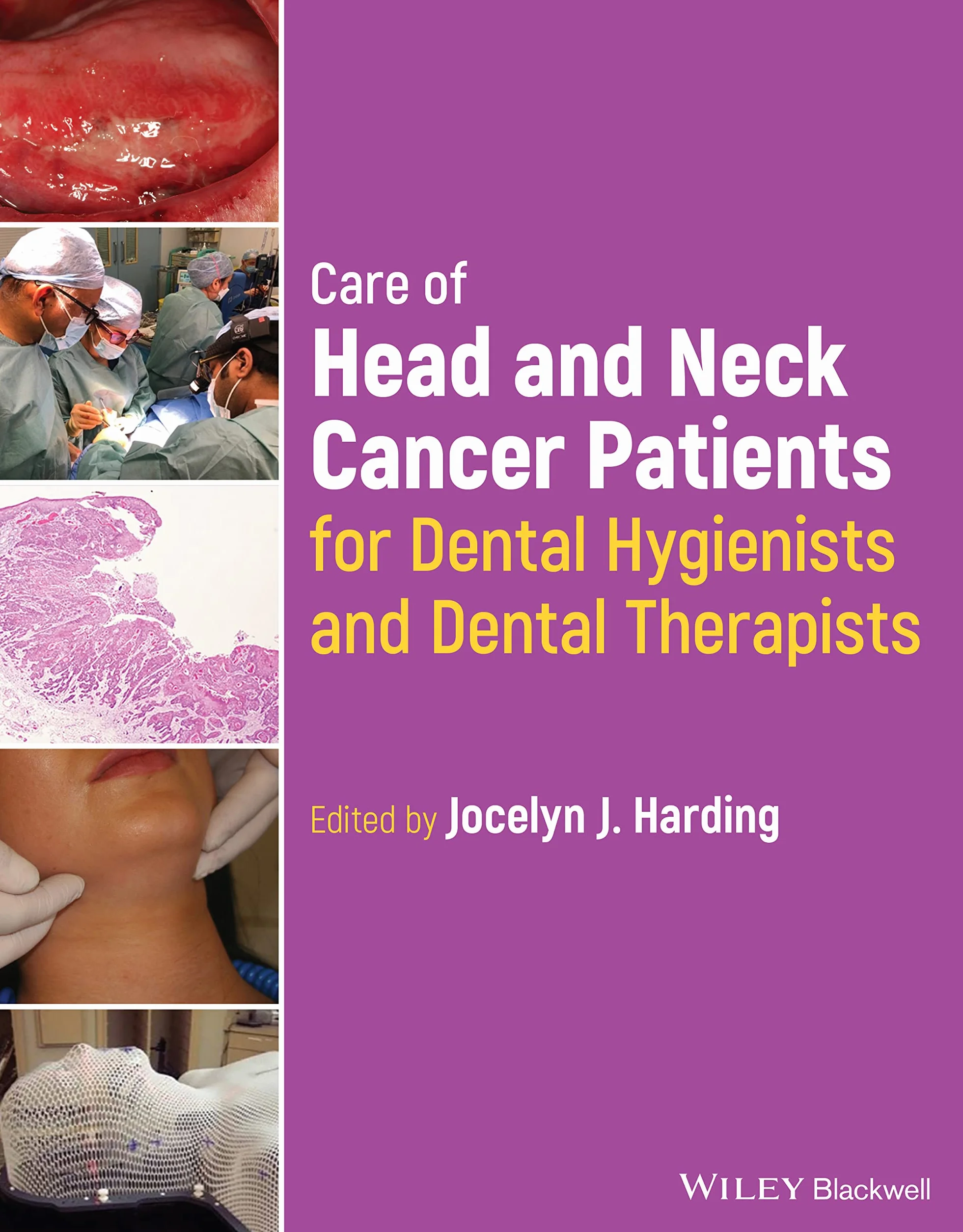 Care of Head and Neck Cancer Patients for Dental Hygienists and Dental Therapists
