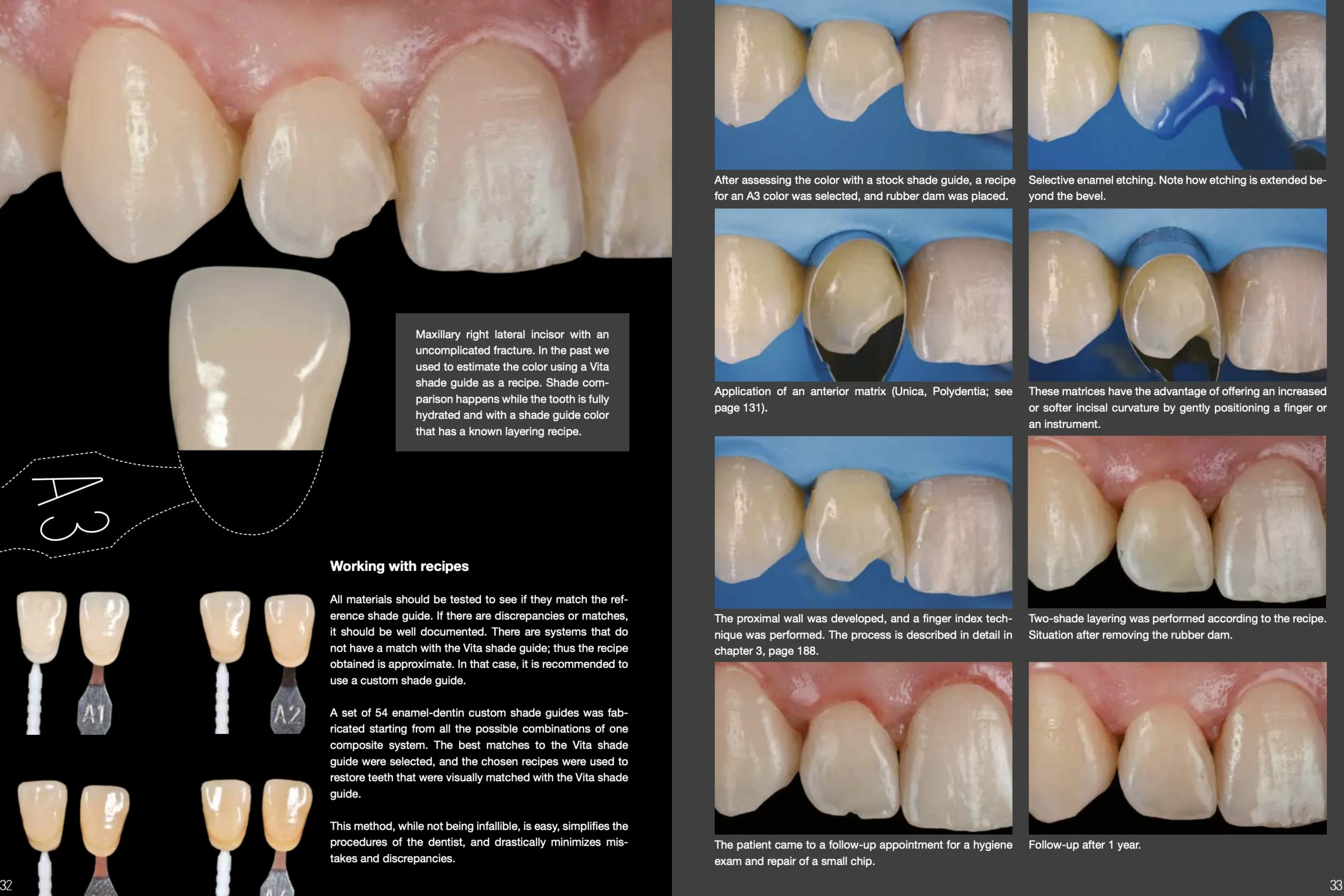 Layers 2. Direct composites: the Styleitaliano clinical secrets. Nuova ediz.
