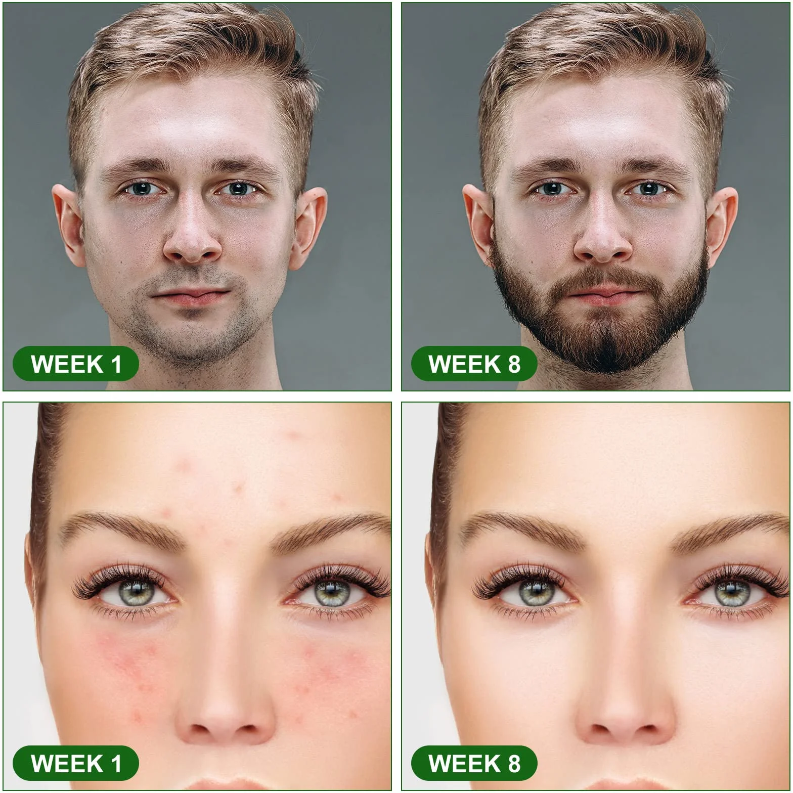 URAQT Derma Roller Titanium 540 do brody i twarzy, stymulacja wzrostu włosów, przeciwzmarszczkowy