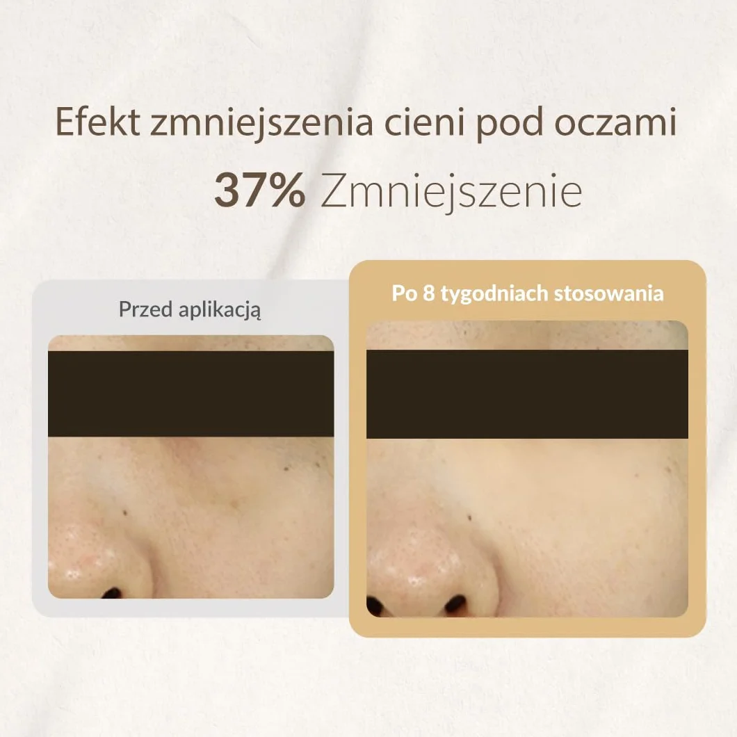 [MIZON] SNAIL REPAIR EYE CREAM (25 ml) Koreańska pielęgnacja - Regenerujący krem pod oczy - Przeciw starzeniu i Korektorom - Połysk i Twardość - Ekstrakt ze ślinienia ślimaka
