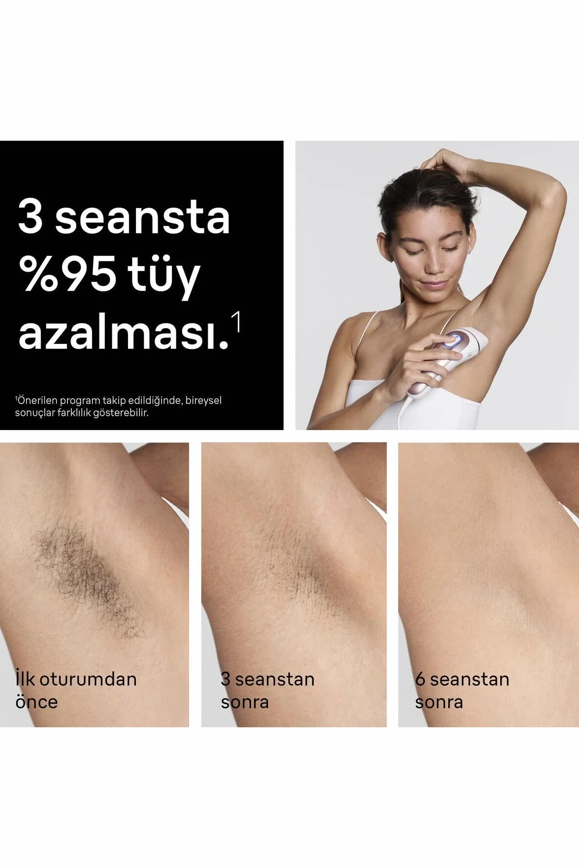 Braun Lumiere Pulsee Intelligent Skin i·expert PL7431 biały brązowy przewodowa depilator IPL 4 głowice aplikacja