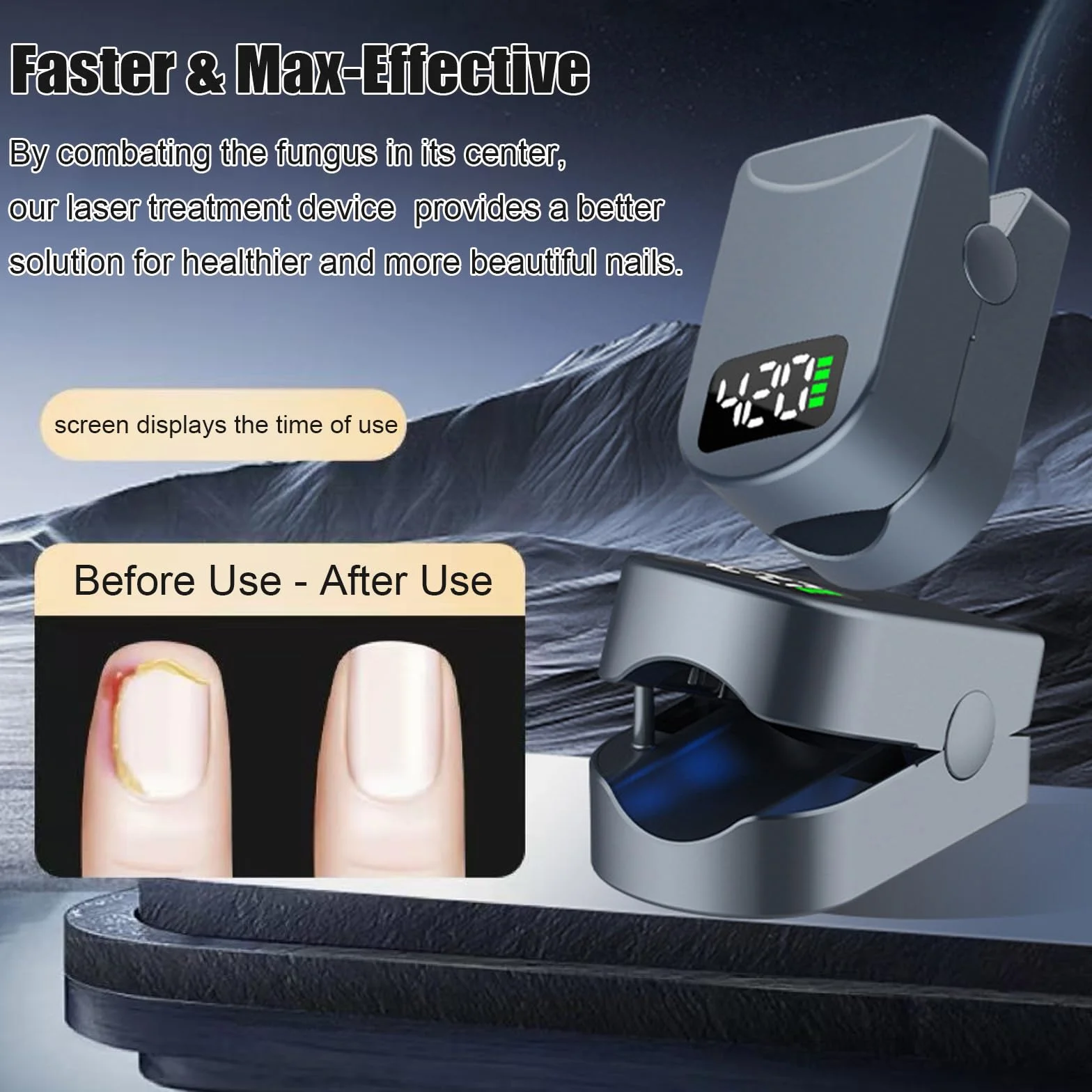 Upgrade Nail Fungus Laser Device with Time Display (D)