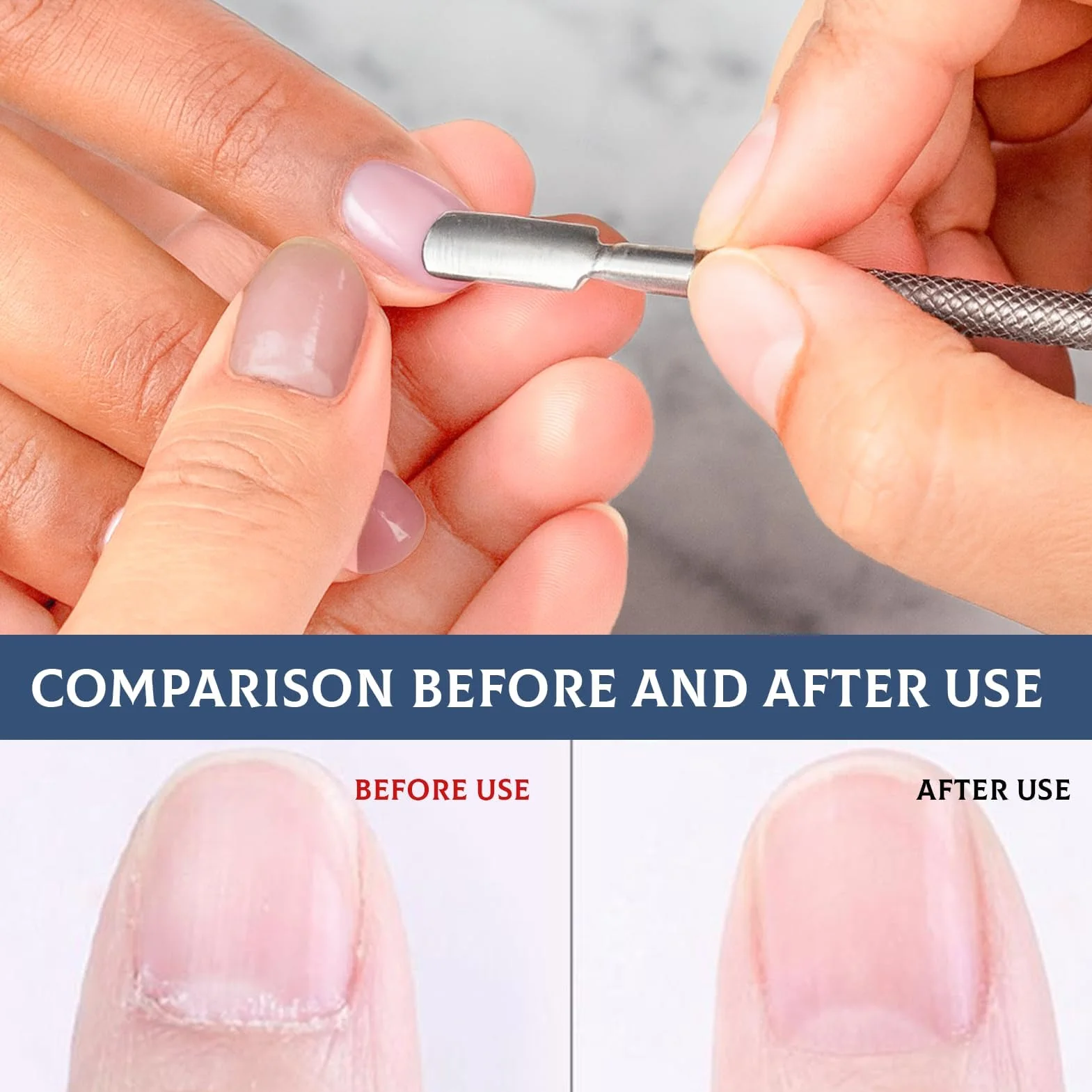 Szczypce do skórek, zestaw do pielęgnacji skórek - szczypce do cięcia skórek, widelcem do skórek, profesjonalne narzędzia do manicure pedicure