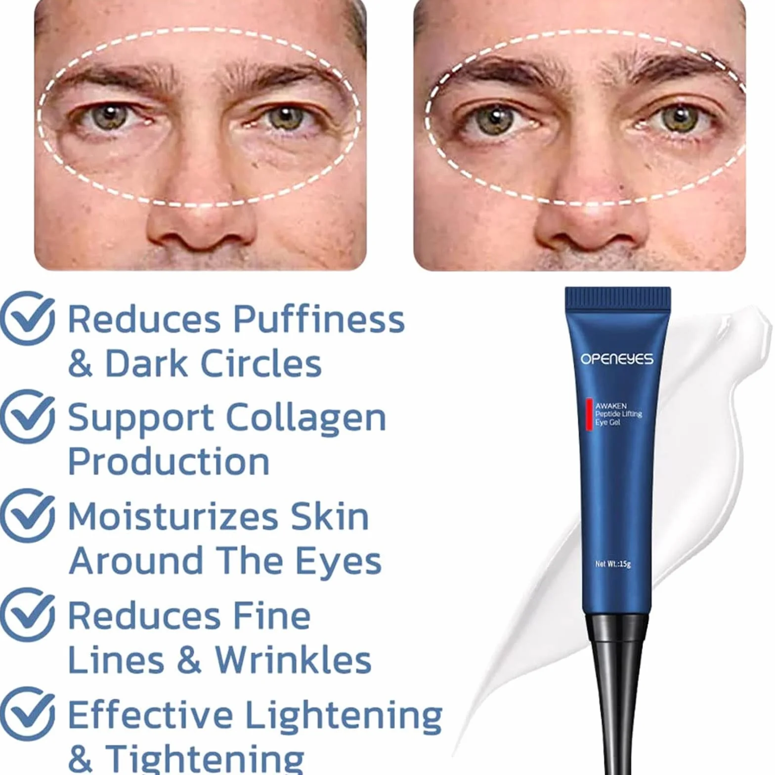Chagoo Openeyes Awaken Peptide Lifting Eye Gel, Nordizoe Openeyes, Nordizoe krem pod oczy, Peptide Eye Gel, Anti-Aging serum pod oczy dla mężczyzn i kobiet (1 szt.)