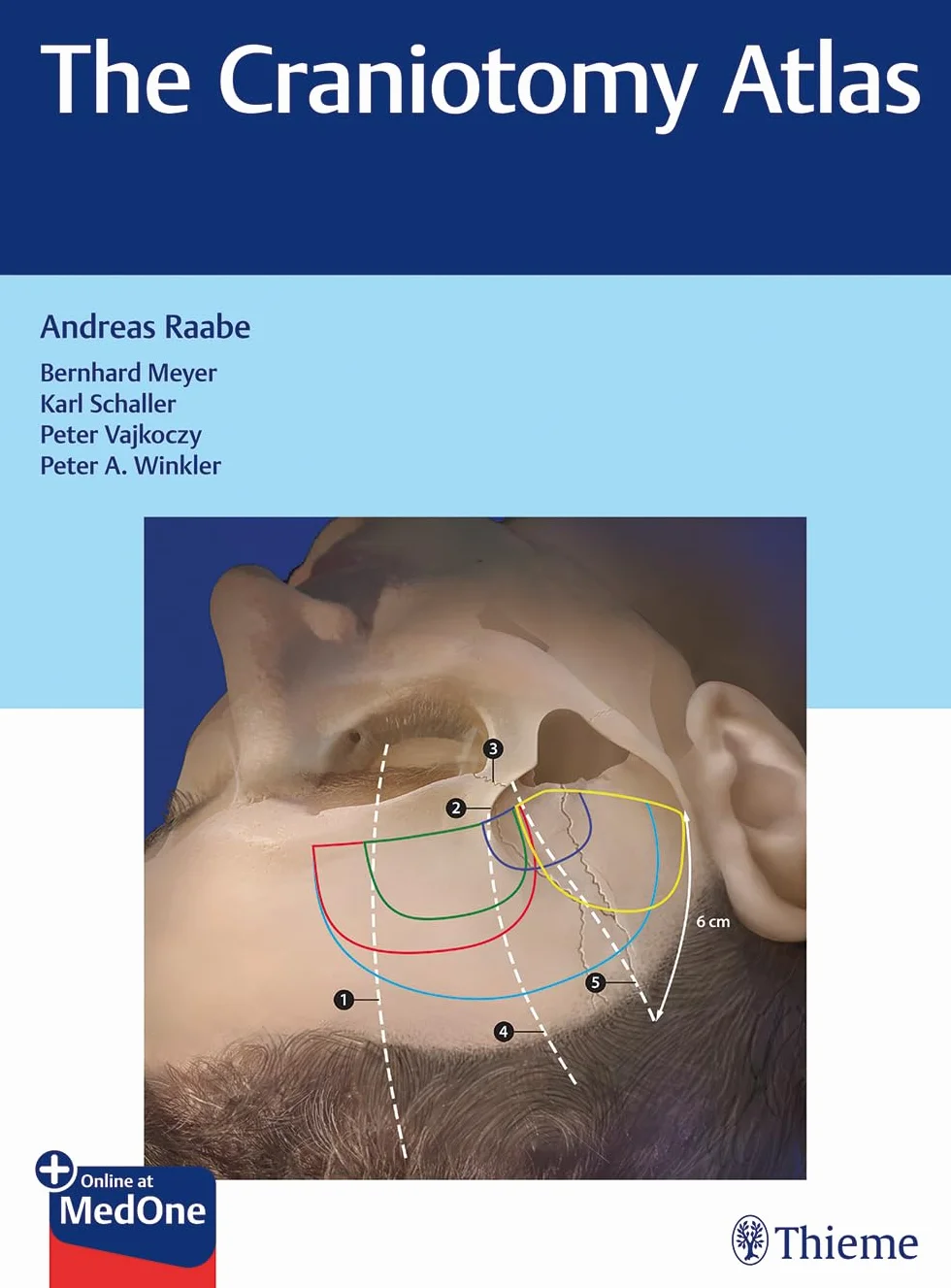 The Craniotomy Atlas