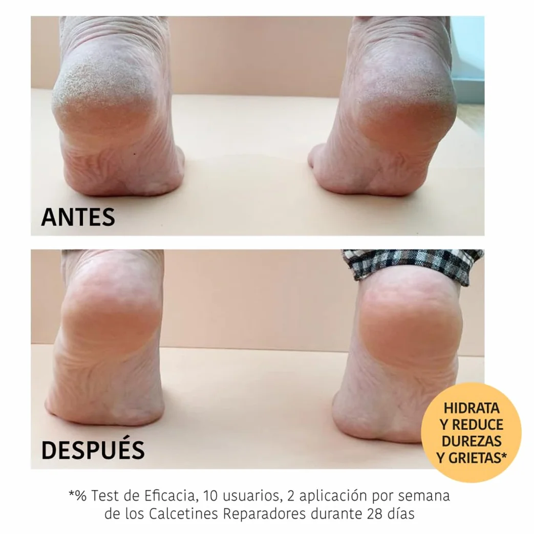 Iroha maska skarpetkowa do stóp Peach Socks naprawa 2 sztuki