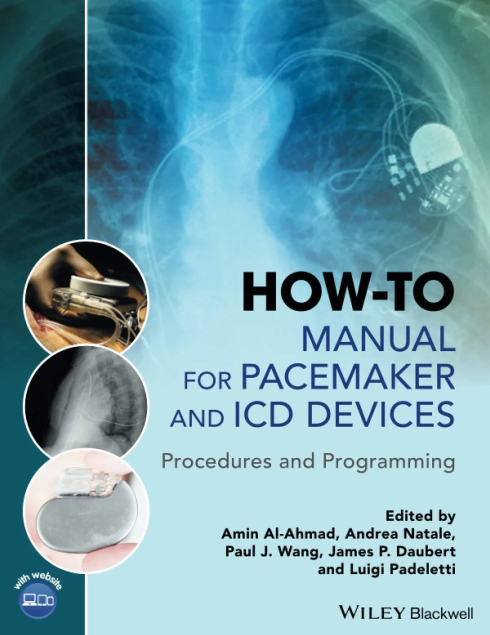 How-To Manual for Pacemaker and ICD Devices: Procedures and Programming
