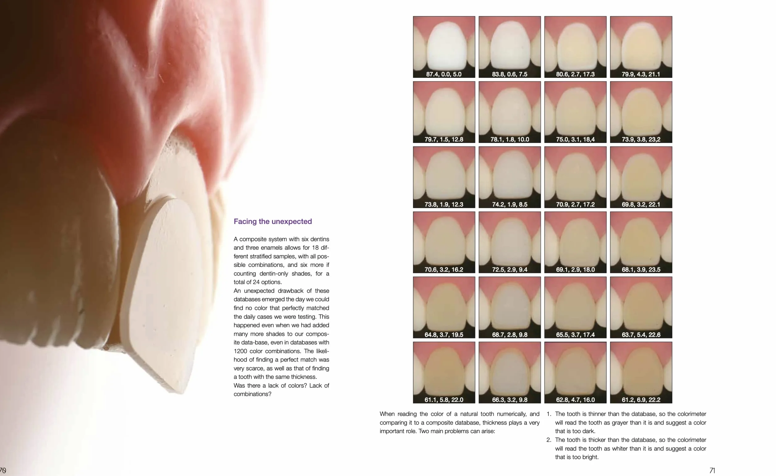 Layers 2. Direct composites: the Styleitaliano clinical secrets. Nuova ediz.