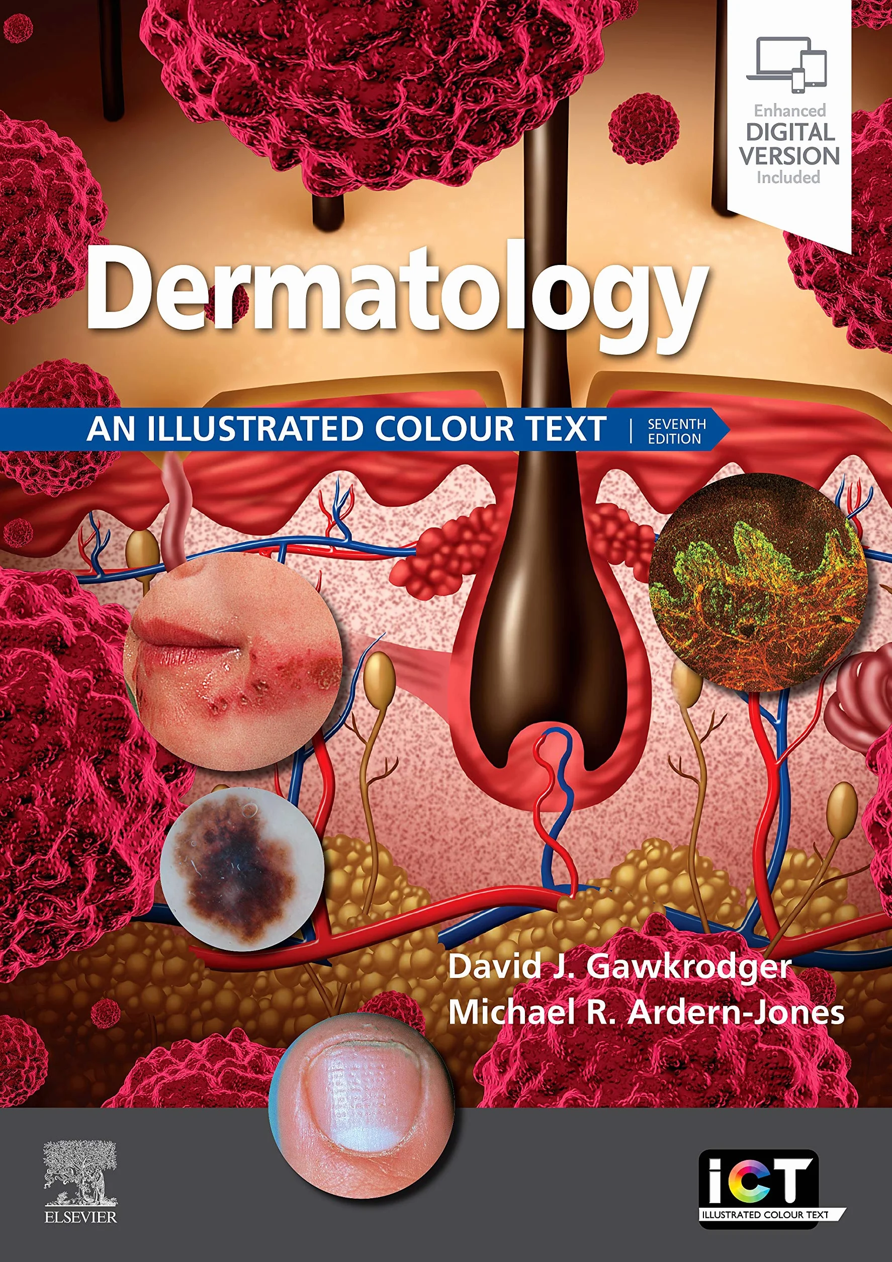 Dermatology: An Illustrated Colour Text