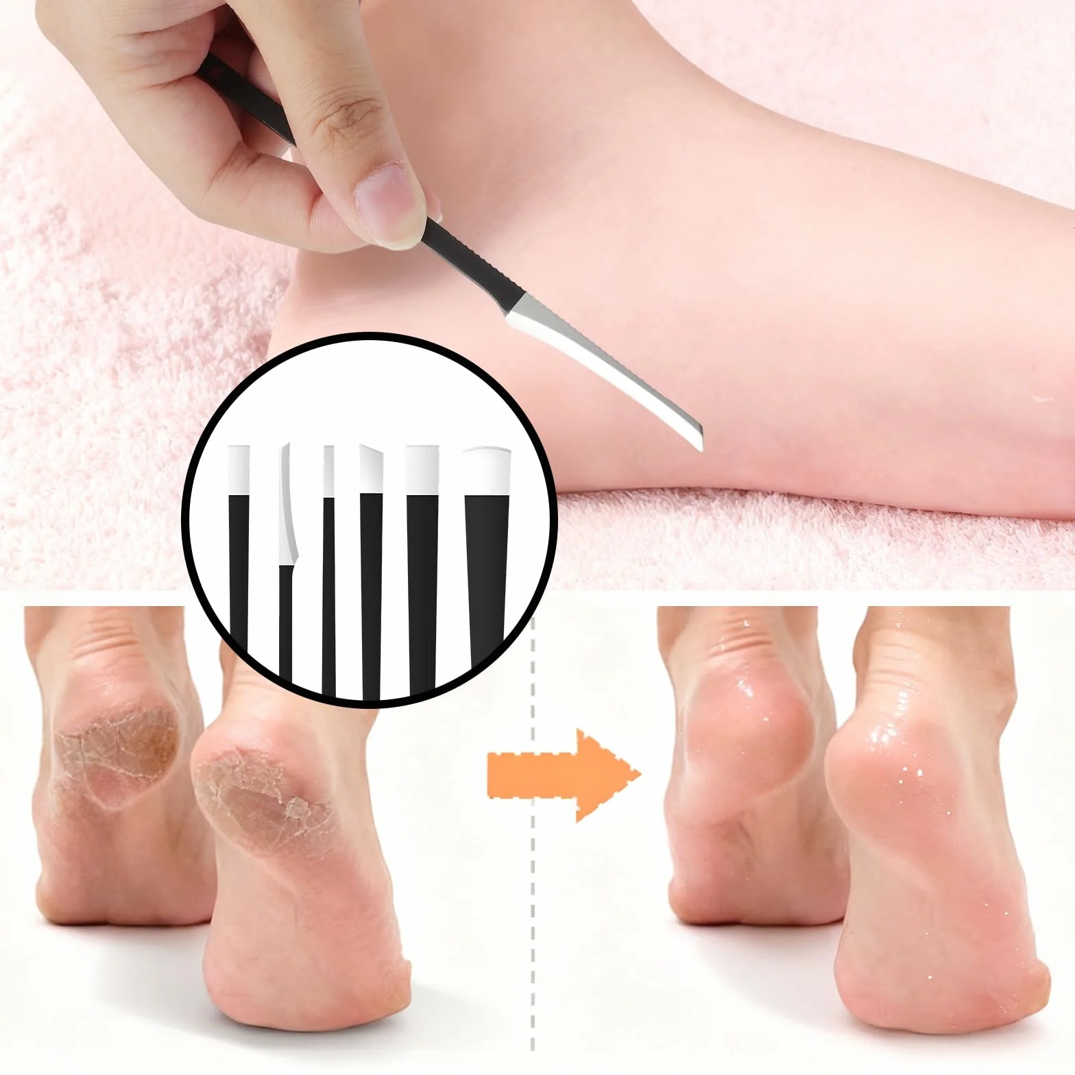 6-częściowy zestaw do pedicure ze stali nierdzewnej, profesjonalny zestaw do wrastających paznokci u stóp z strugą do zrogowaciałej skóry, nóż do pedicure, zestaw do pielęgnacji stóp, z pudełkiem do