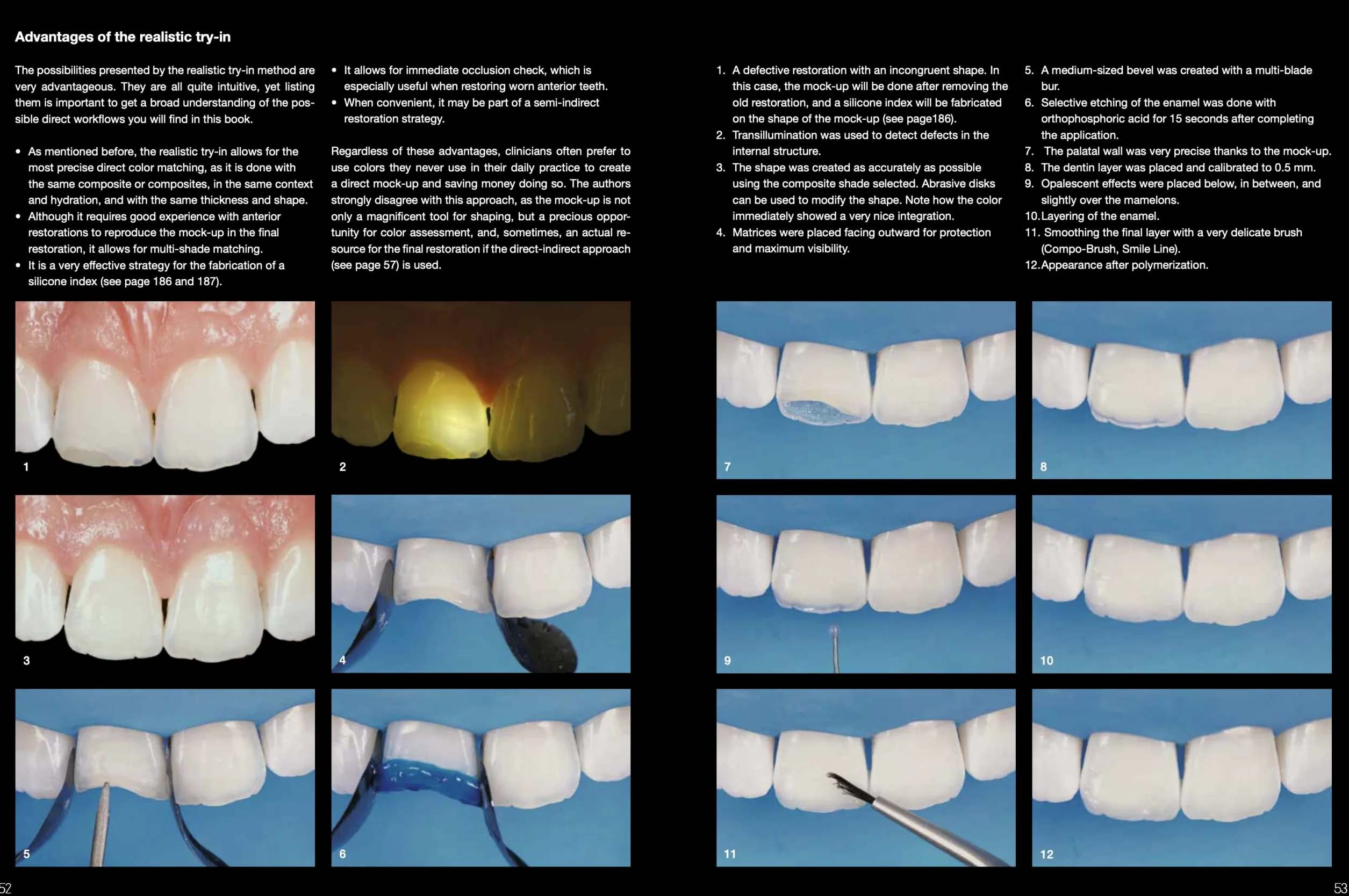 Layers 2. Direct composites: the Styleitaliano clinical secrets. Nuova ediz.