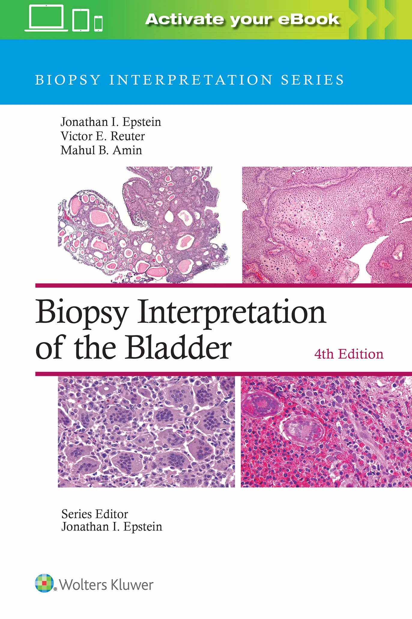 Biopsy Interpretation of the Bladder: Print + eBook with Multimedia