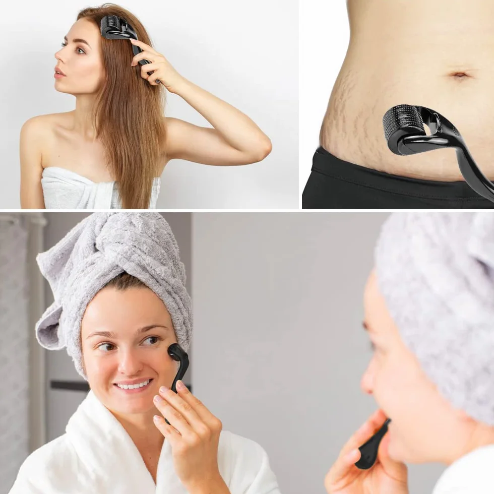 Derma Roller 1 mm 1,5 mm, wałek do mikroigłowania, wałek do brody, z 540 igłami, mikroigły, derma roller dla mężczyzn i kobiet, pielęgnacja włosów, twarzy i ciała, rozstępy, czarne